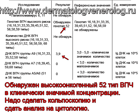 так можно интерпретировать анализ на ВПЧ