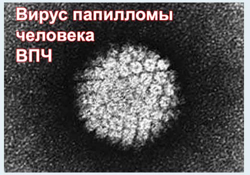 Вирус папилломатоза человека впч thumbnail
